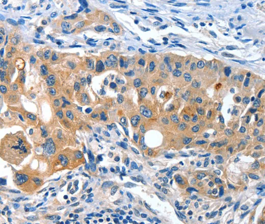 AMHR2 Polyclonal Antibody - image 1