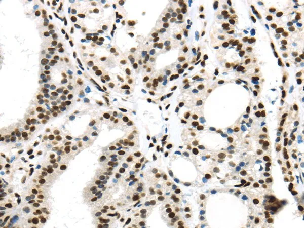 DDX39B Polyclonal Antibody - image 1