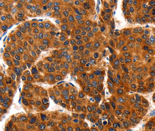 HSP75 Polyclonal Antibody - image 1
