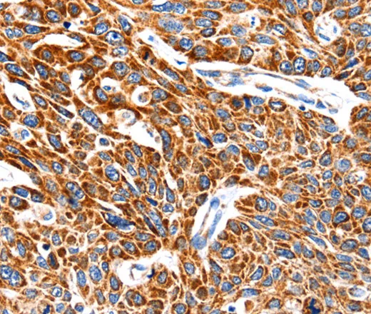 HSP75 Polyclonal Antibody - image 2