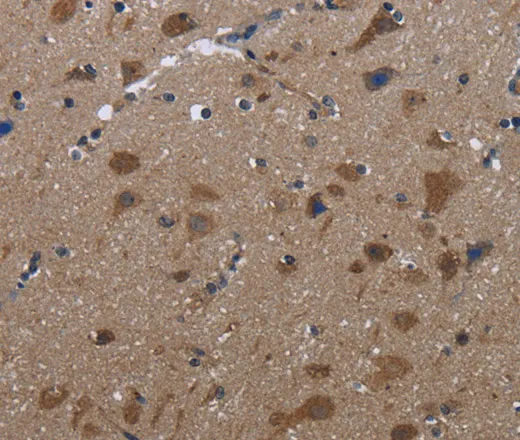 LETMD1 Polyclonal Antibody - image 1