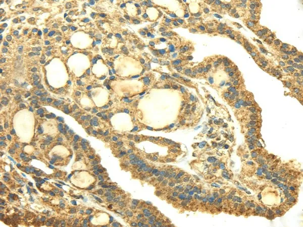 SDHA Polyclonal Antibody - image 1