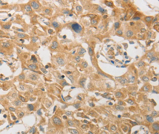 PLPP1 Polyclonal Antibody - image 1