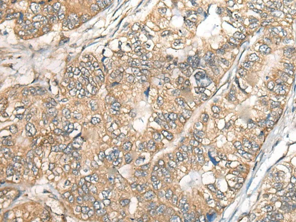 BCHE Polyclonal Antibody - image 1