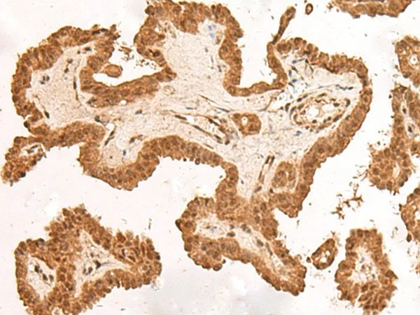 ARMC8 Polyclonal Antibody - image 1
