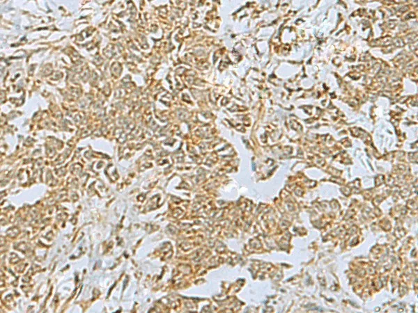 FAAP100 Polyclonal Antibody - image 1