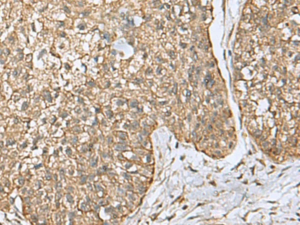 EIF4A2 Polyclonal Antibody - image 1