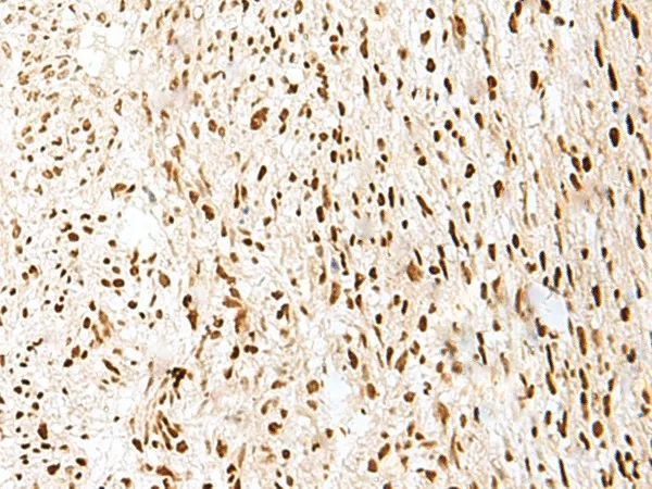PRPF3 Polyclonal Antibody - image 1