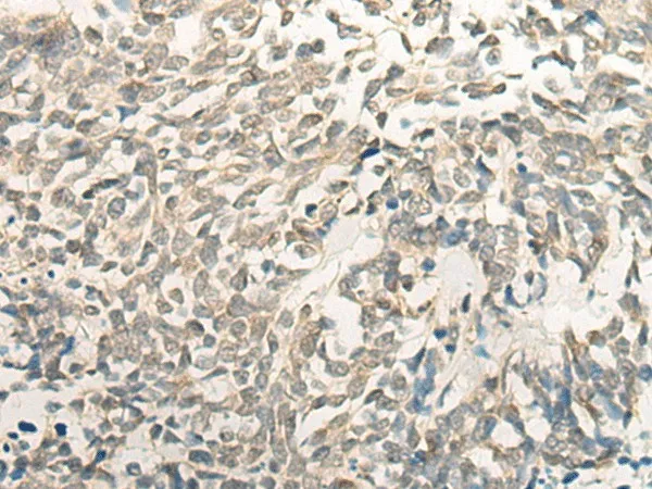 BCAS3 Polyclonal Antibody - image 1