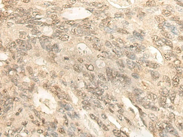 BCAS3 Polyclonal Antibody - image 2