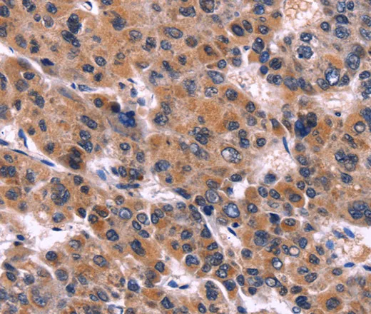 EIF2AK4 Polyclonal Antibody - image 1