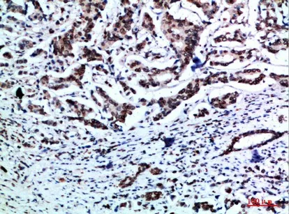 Vimentin Polyclonal Antibody - image 1