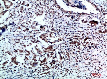 Vimentin Polyclonal Antibody - image 2