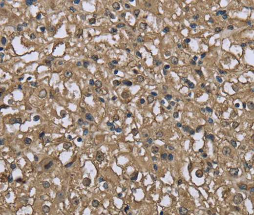FBP1 Polyclonal Antibody - image 1