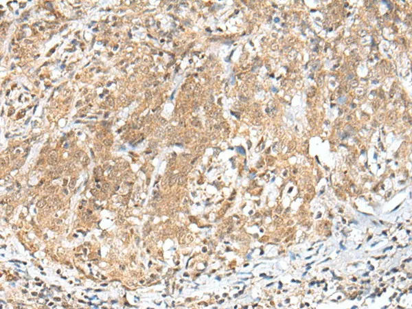 PEG3 Polyclonal Antibody - image 1