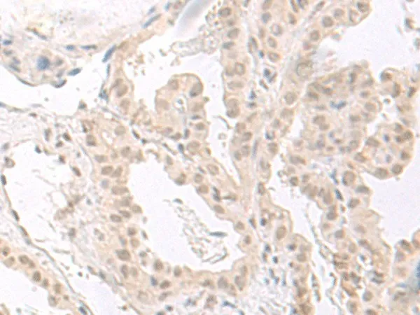 HOOK2 Polyclonal Antibody - image 1
