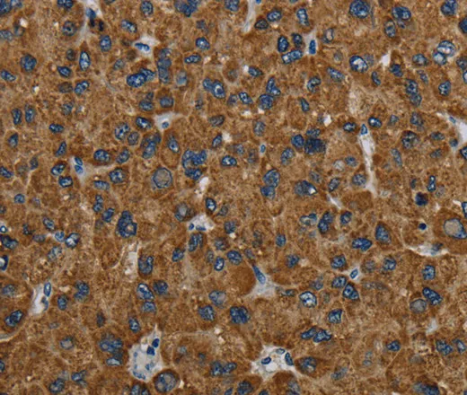 PCK2 Polyclonal Antibody - image 1