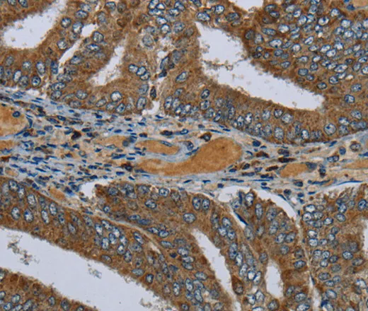 PCK2 Polyclonal Antibody - image 2