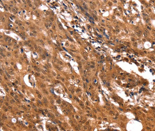 ERN2 Polyclonal Antibody - image 1