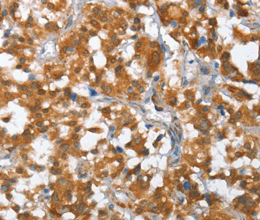 TP53BP2 Polyclonal Antibody - image 1