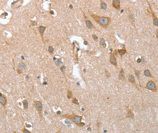 TP53BP2 Polyclonal Antibody - image 2