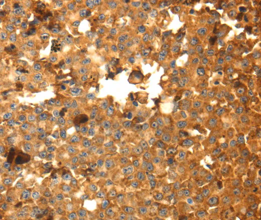 DRD5 Polyclonal Antibody - image 1