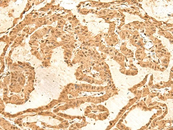TIPRL Polyclonal Antibody - image 1