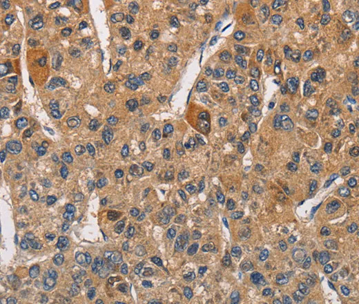 RICTOR Polyclonal Antibody - image 1