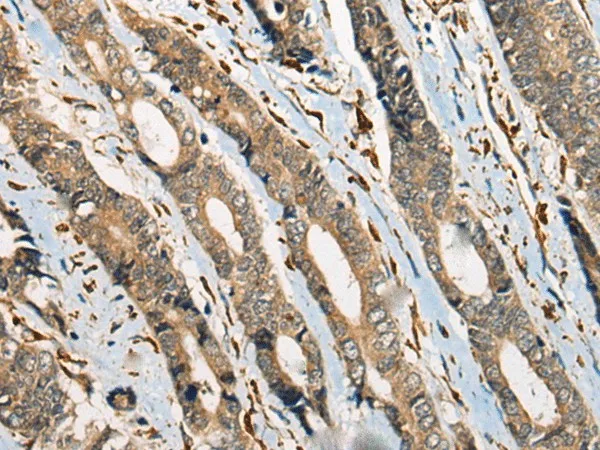 ODF2 Polyclonal Antibody - image 1