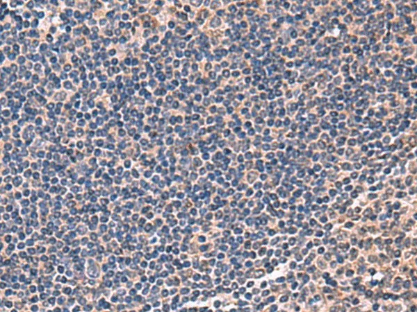 IPPK Polyclonal Antibody - image 1