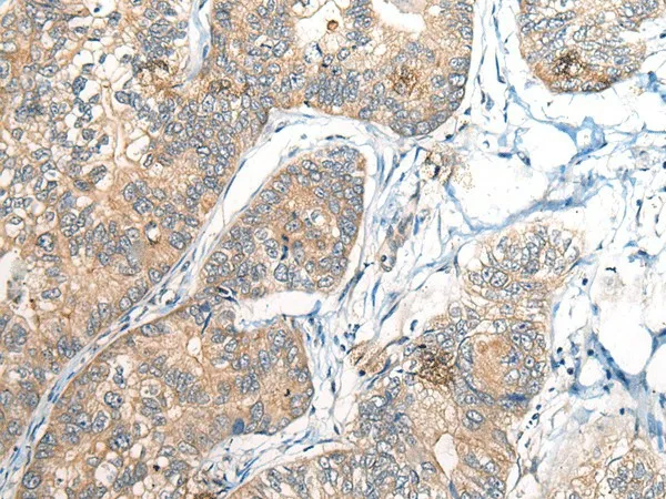 BCAN Polyclonal Antibody - image 1