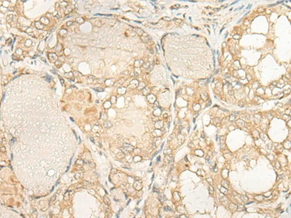 DUSP27 Polyclonal Antibody - image 1