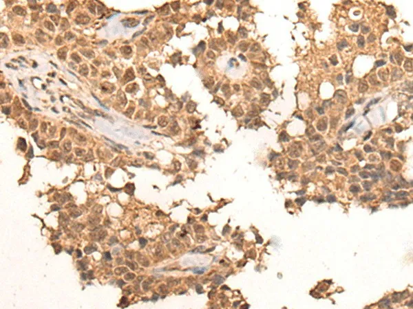 CLK2 Polyclonal Antibody - image 1