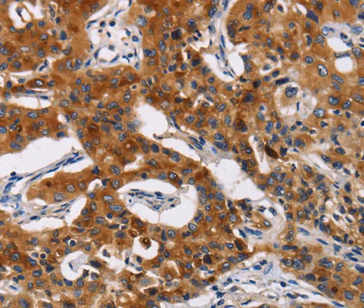MSLN Polyclonal Antibody - image 1