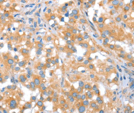 ST14 Polyclonal Antibody - image 1