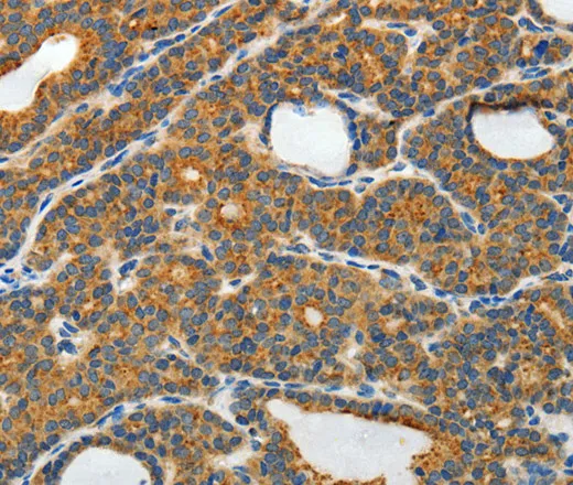 RAMP3 Polyclonal Antibody - image 1