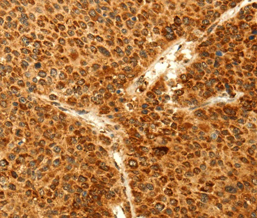 GRM3 Polyclonal Antibody - image 1