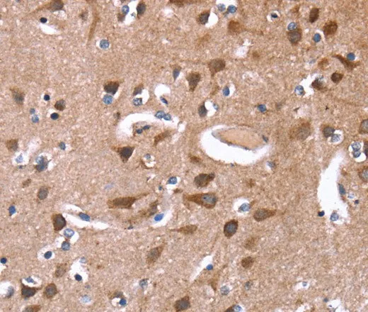 GREB1 Polyclonal Antibody - image 1