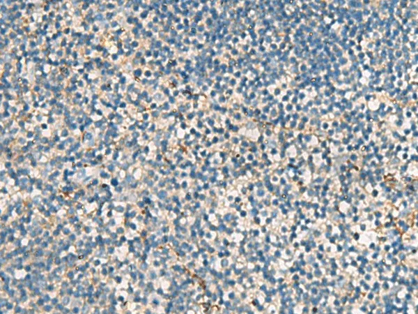 ACTC1 Polyclonal Antibody - image 1