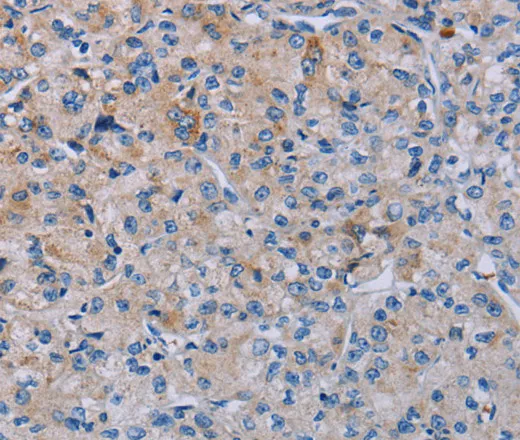 P2RY2 Polyclonal Antibody - image 1