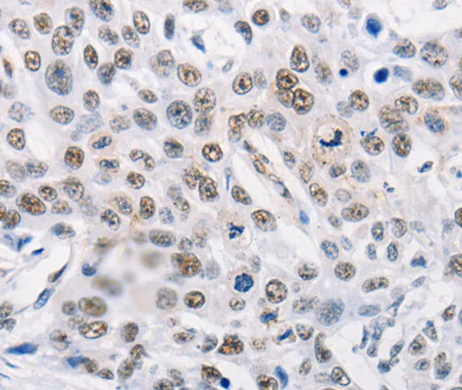 TRIM63 Polyclonal Antibody - image 1