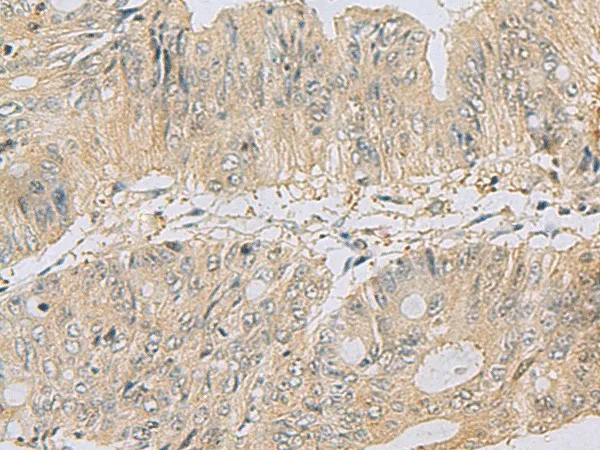 TSTA3 Polyclonal Antibody - image 1
