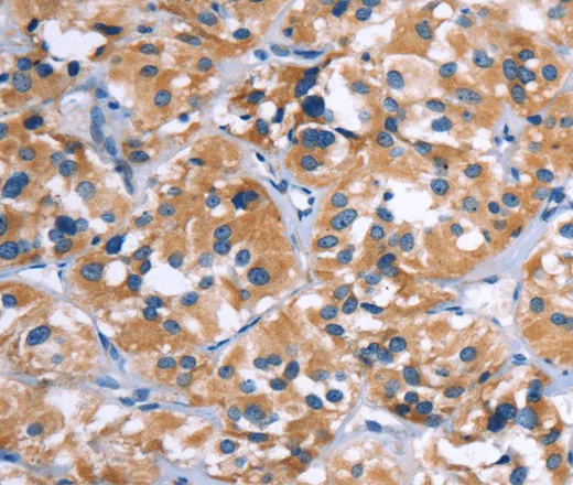 COMP Polyclonal Antibody - image 1