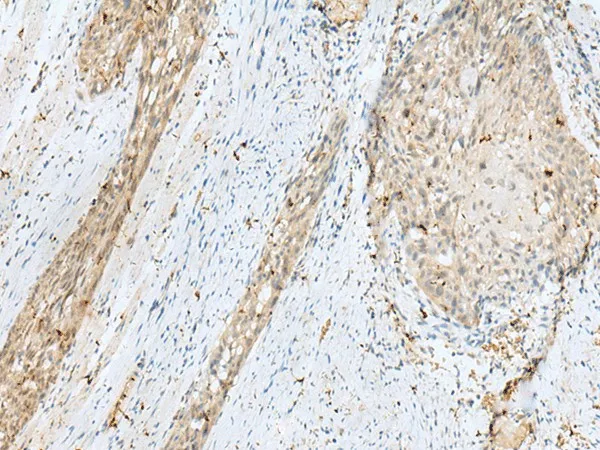TEX11 Polyclonal Antibody - image 1