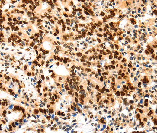 PCNA Polyclonal Antibody - image 1