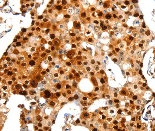 PCNA Polyclonal Antibody - image 2