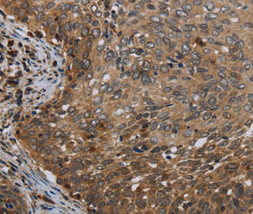 MT-ND6 Polyclonal Antibody - image 1