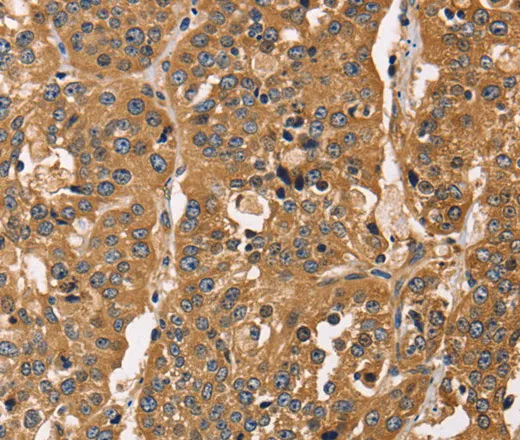 CAPZA3 Polyclonal Antibody - image 1