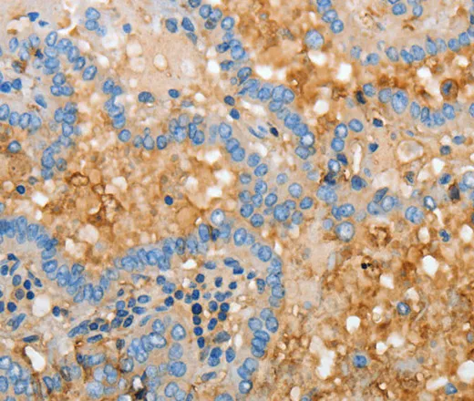 APOH Polyclonal Antibody - image 1