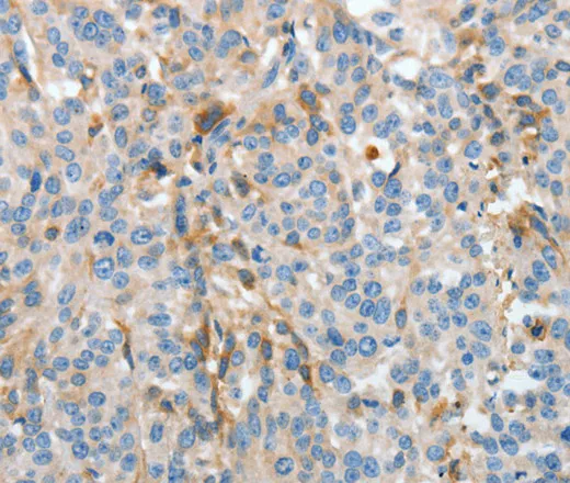 APOH Polyclonal Antibody - image 2